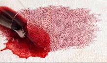 How To Remove Carpet Stains Quickly